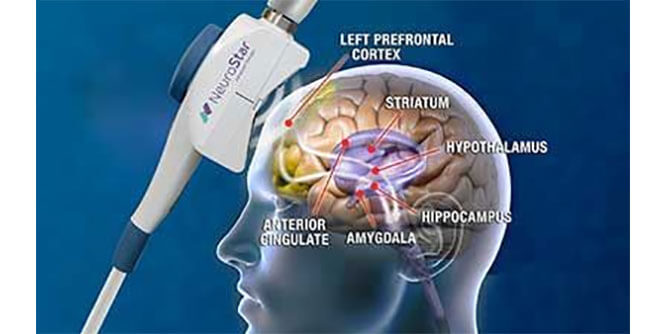 Zion Healing Centers Slider-3