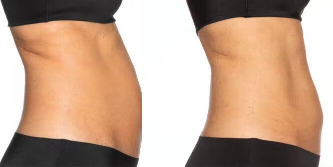 Serotonin Anti-Aging Centers Slider-1