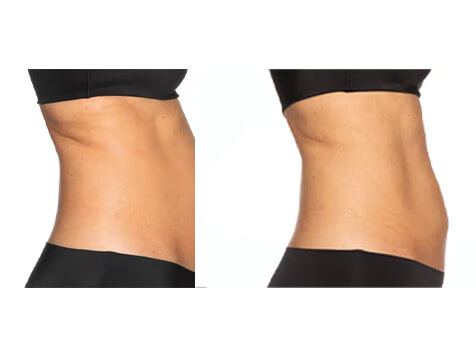 Serotonin Anti-Aging Centers Serotonin Anti-Aging Centers Slider 5