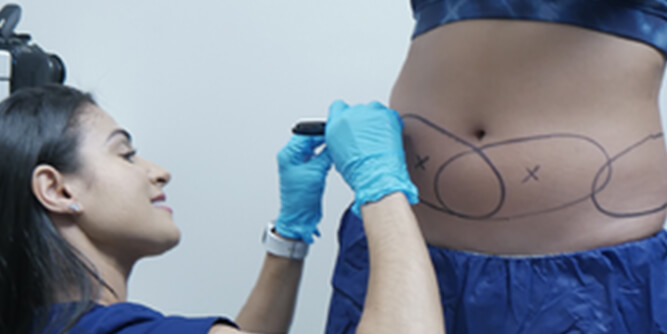 BodEnvy Coolsculpting Slider-4