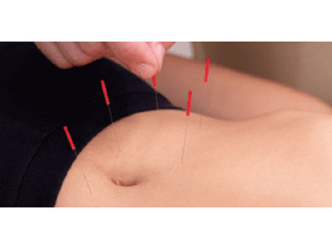 BodyWorkz - Chiropractic, Acupuncture, Massage BodyWorkz - Chiropractic, Acupuncture, Massage Slider 2