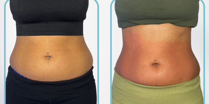 360 Age Reversal™ Business-in-a Box Slider-3