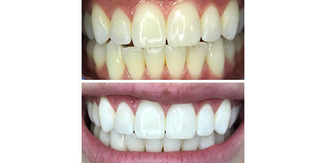 Fresh Effects Slider-6