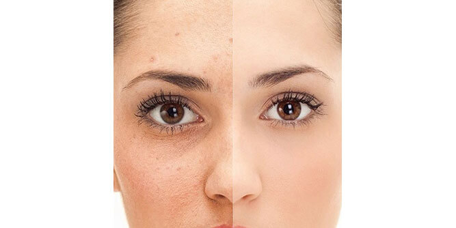 The Natural Place MedSpa Slider-6