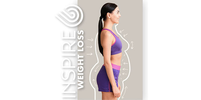 Inspire Weight Loss Slider-2