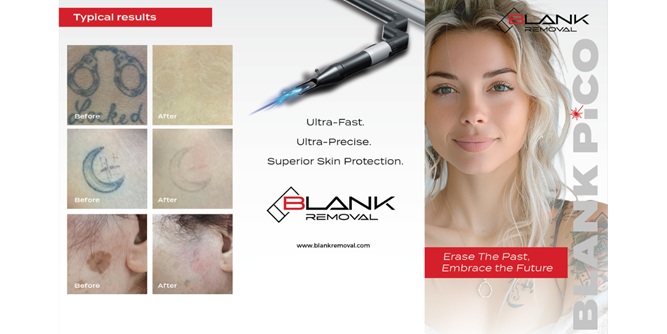 Blank Removal Slider-3